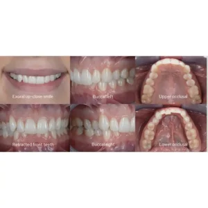 رینگ فلاش گودکس Godox MF12-DK1 Dental Macro Sony